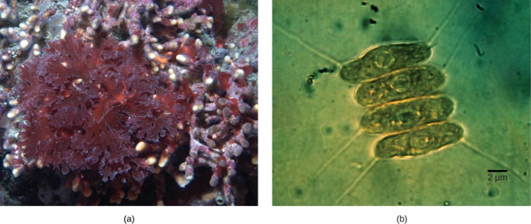 Red and green algae micrographs.