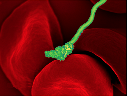 Green bacterial cell attacking a human red blood cell.