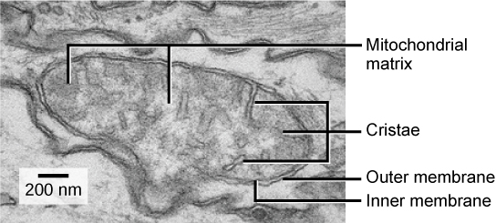 Mitochondrian electron micrograph.