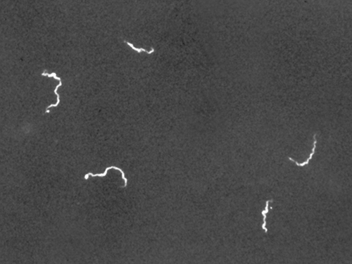 Spirochete Treponema pallidum (squiggly white lines) viewed using a darkfield microscope.