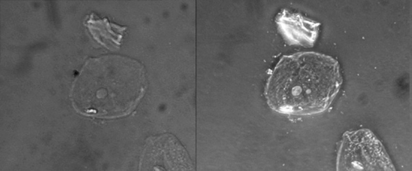 Simple squamous epithelial cells viewed through a phase-contrast microscope versus a brightfield microscope.