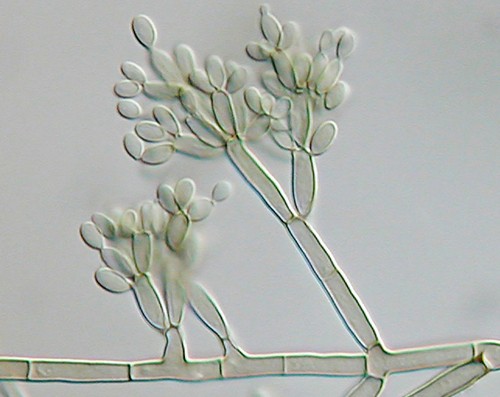Fonsecaea pedrosoi viewed through a DIC microscope.
