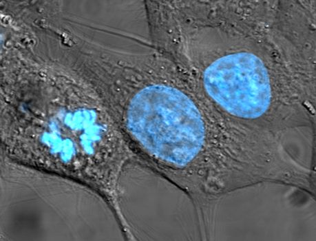 Cultured HeLa cells with neon blue nuclei