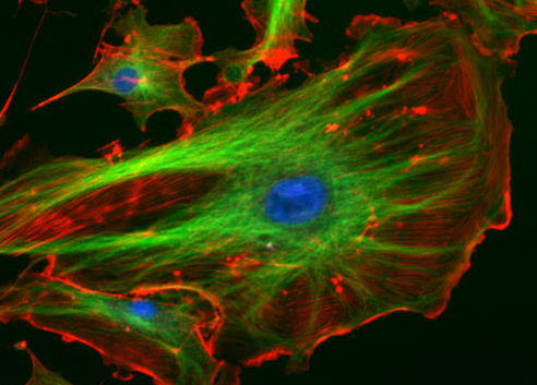 Bovine pulmonary artery endothelial cells glowing neon red, green, and blue.