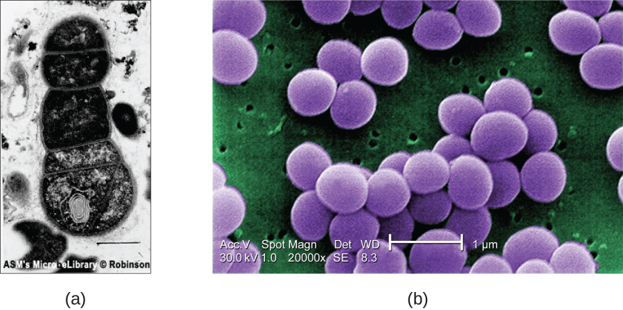 (a) Cells viewed through a transmission electron microscope. (b) Staphylococcus aureus viewed through a scanning electron microscope.