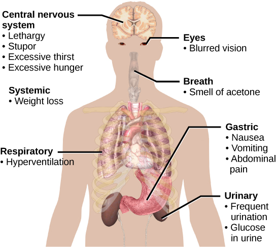 Diabetes symptoms in the body.