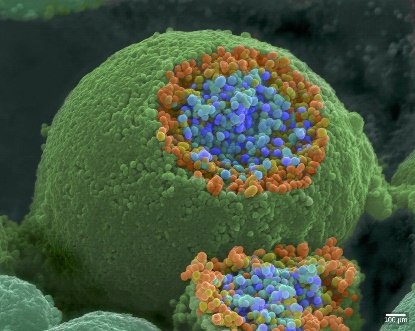 Synaptic vesicles.