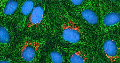 A multiphoton fluorescence image of HeLa cells in culture.