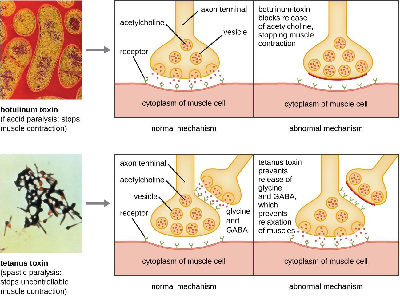 Mechanisms of botulinum and tetanus toxins.