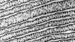 A micrograph showing RER under a higher magnification.